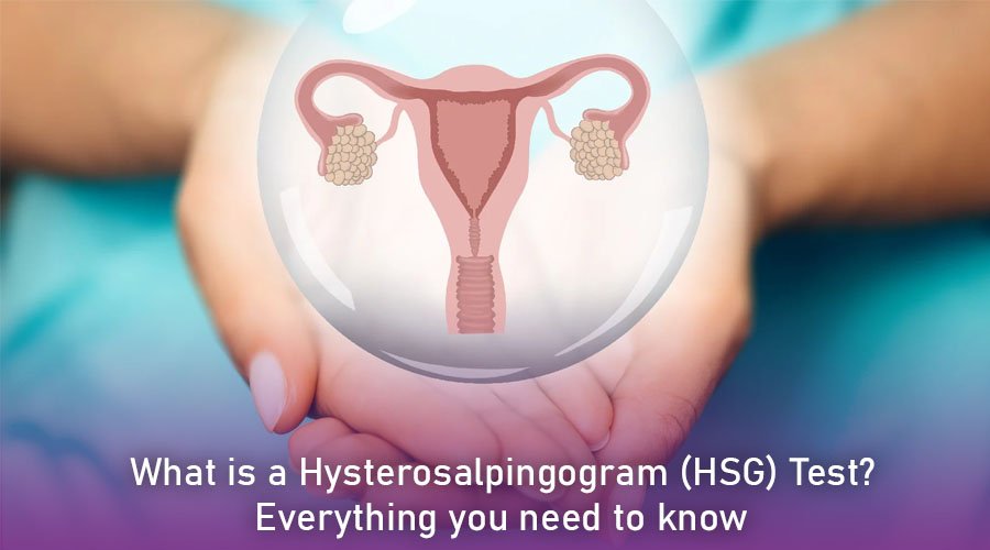 What is a hysterosalpingogram (HSG) test? Everything you need to know