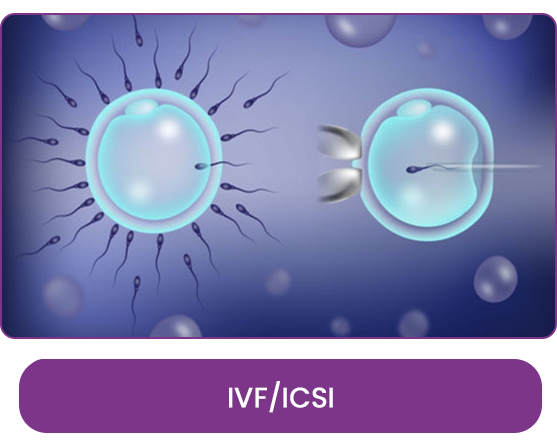 Best IVF center in Delhi NCR