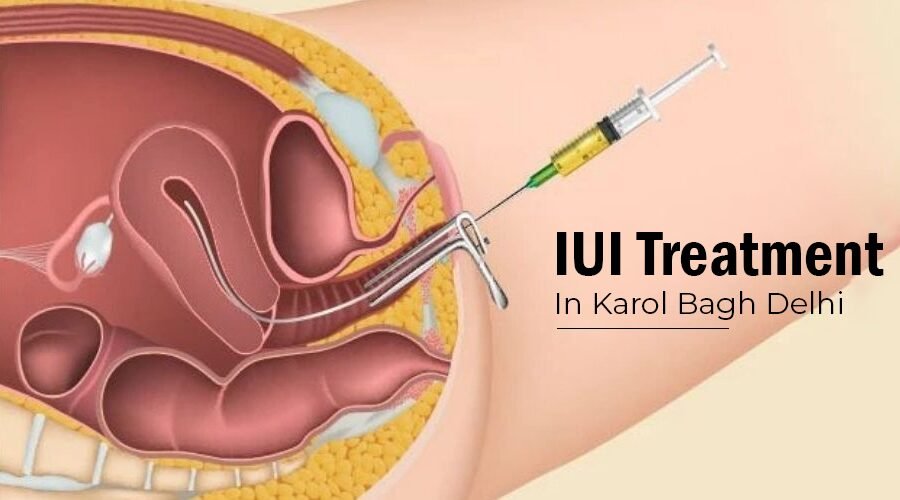IUI Treatment in Karol Bagh Delhi NCR